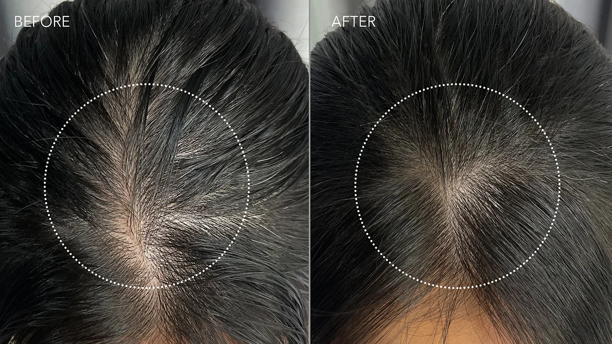 Scalp closeup Luna Dual Peptide Scalp Serum Before and After
